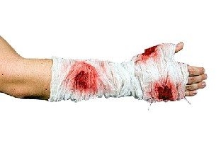 Blutiger Arm-Verband